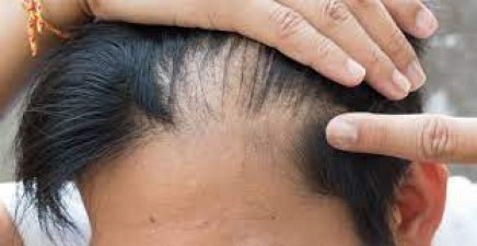 Scratching the Surface: Dealing with Itchy Scalp Woes