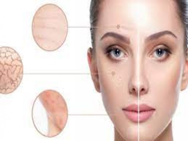 getting-rid-of-dark-spots-tips-for-a-clearer-complexion-newstrack