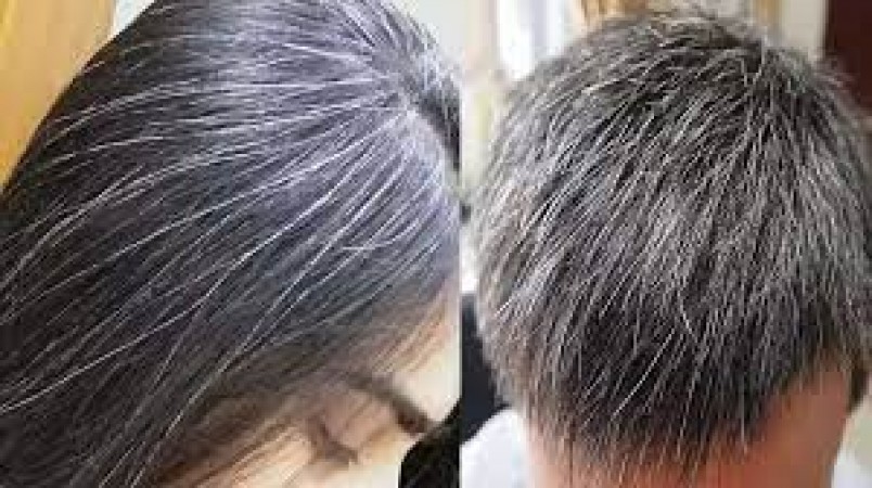 White Hair: White hair will turn black with this kitchen item, know how to use it