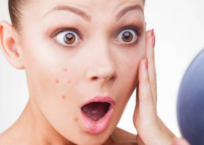 Consume these foods to get rid of the pimples pimples