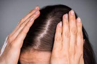 There can be many reasons behind hair thinning! Adopt this hair care routine