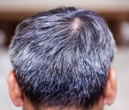 Tired of Gray Hair, 5 Best Ayurvedic remedies to get rid of it
