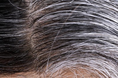 Deficiency of which vitamin causes gray hair?