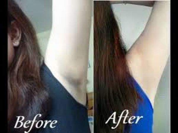 Tips to get clean and clear underarms | NewsTrack English 1