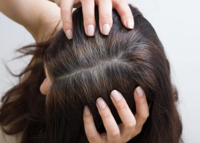 5 Ayurvedic Remedies to Reverse Hair Greying Naturally