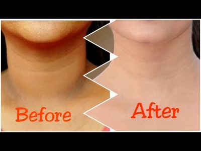 3 Steps to clean your dark neck