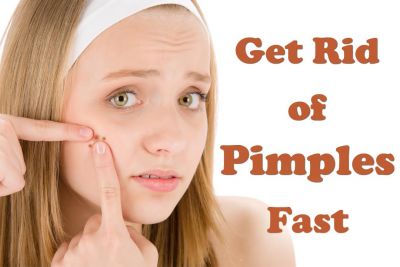 3 Bedtime ways to get rid of pimples quickly
