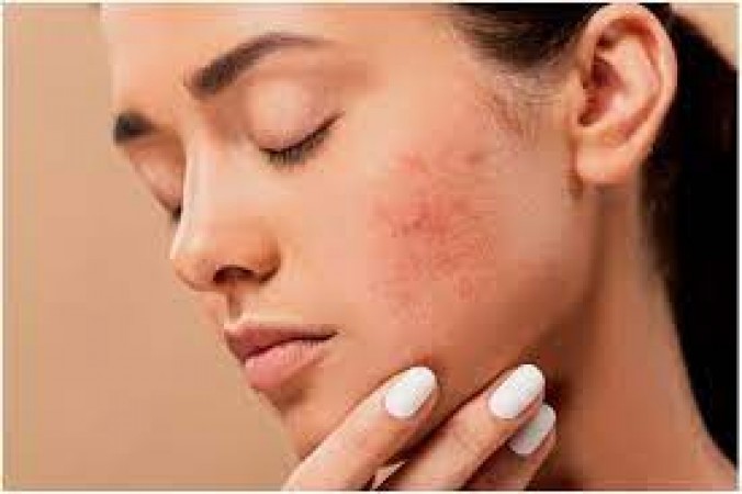 Don't make these skin related mistakes even at night