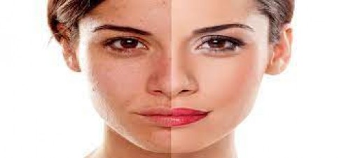 If you want to have spotless and beautiful skin, then give up these habits, otherwise freckles will spoil your face
