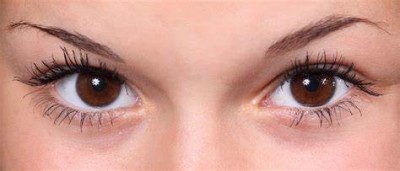 Are Eye Fillers Right for You?