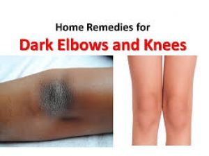 Do your elbows and knees seem dim and grubby?