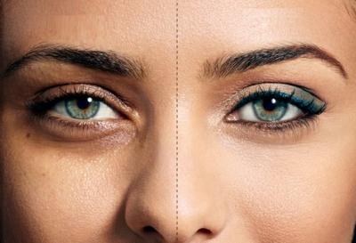3 remedies to keep your skin under the eye healthy