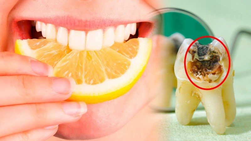 दांतों को हानि पहुंचा सकते है इस प्रकार के फास्टफूड