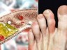 Changing color of the skin of feet gives warning of high cholesterol, know its other symptoms