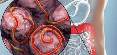 Do not ignore these symptoms seen in the body, there may be worms in the stomach