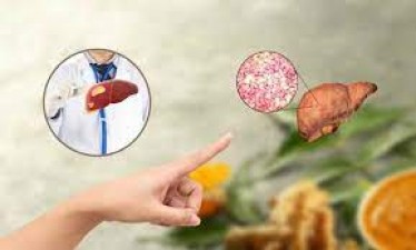 These 4 prescriptions of Ayurveda will protect from fatty liver! Know