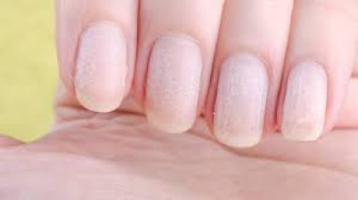 Nails can tell the condition of Vitamin B-12 in the body