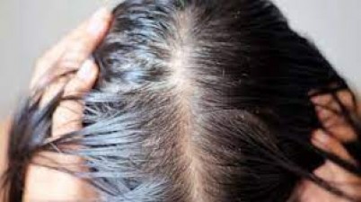 Hair falling rapidly? Are you seriously ill? Understand your body's signals