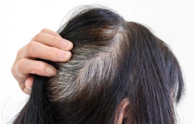 If Your Hair Has Turned Gray at a Young Age, Follow These Tricks for Relief