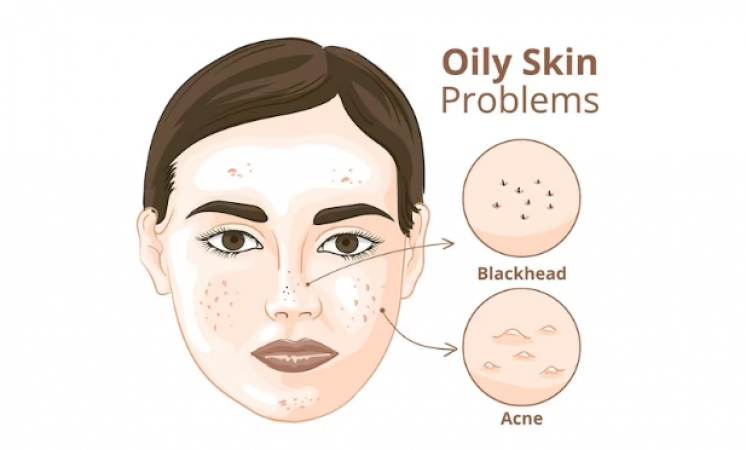 Avoid these 5 things if you have oily skin