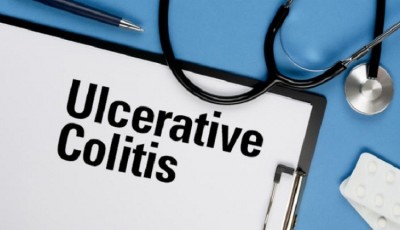 Understanding Ulcerative Colitis: Causes, Symptoms, and Prevention Strategies