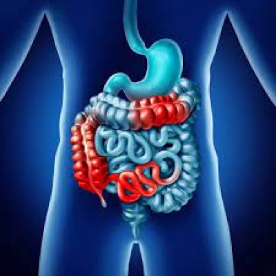 Bowel Disorders Symptoms: In this disease, the intestine starts swelling, know its initial symptoms