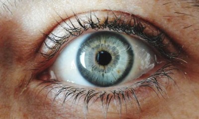 Understanding Eye Floaters: Causes, Symptoms, Prevention, and Treatments