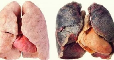 How Healthy Are The Lungs Of A Smoker