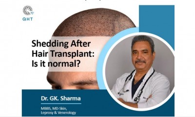 Dr G K Sharma on why hair shedding occurs after a Hair Transplant procedure
