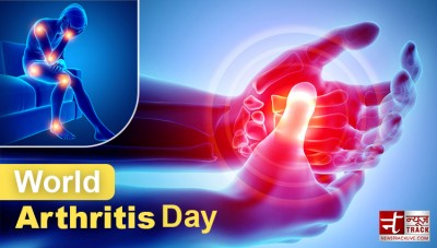 Understanding Arthritis: Symptoms, Causes, and Prevention