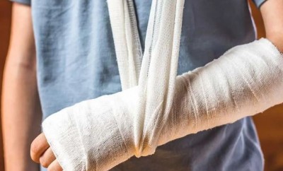 Effective ways to heal your Broken Bones after Fracture