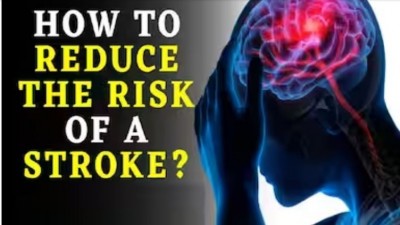 World Stroke Day: How Lifestyle Choices Impact Your Stroke Risk