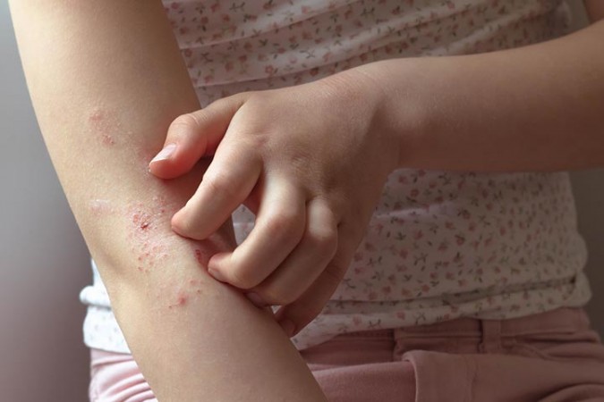 डिहाइड्रेशन की वजह से ड्राई हो गई है बच्चों की त्वचा, तो अपनाएं ये घरेलू उपाय