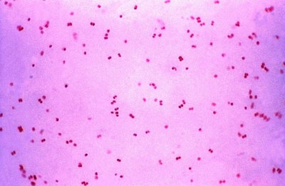 मेनिंगोकोकी जो एक संक्रामक बैक्टीरिया है, इससे आपको भी हो सकता है खतरा