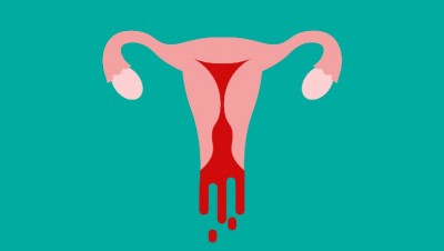सेक्स के बाद योनि से रक्तस्राव, जानिए इसके कारणों को