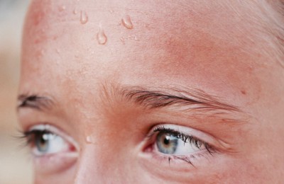 Does Your Head Sweat Too? Be Cautious, as It Can Pose Elevated Risks