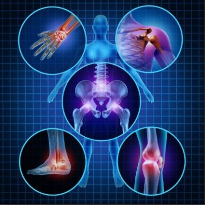 How many types of arthritis are there, identify them by symptoms, know the role of physiotherapy in treatment