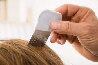 Troubled by lice in hair, adopt 6 home remedies to remove them