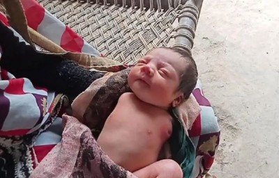 A unique baby girl born in MP, crowd of people gathered to see