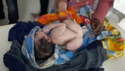 People were shocked to see the birth of a unique child in Bihar