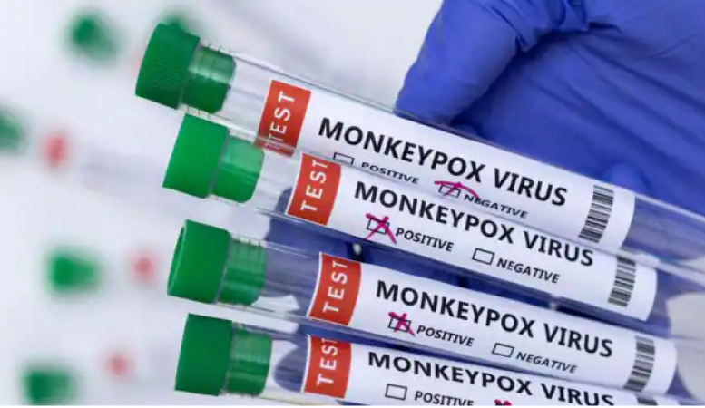 Japan Health Ministry approves smallpox vaccine to curb monkeypox