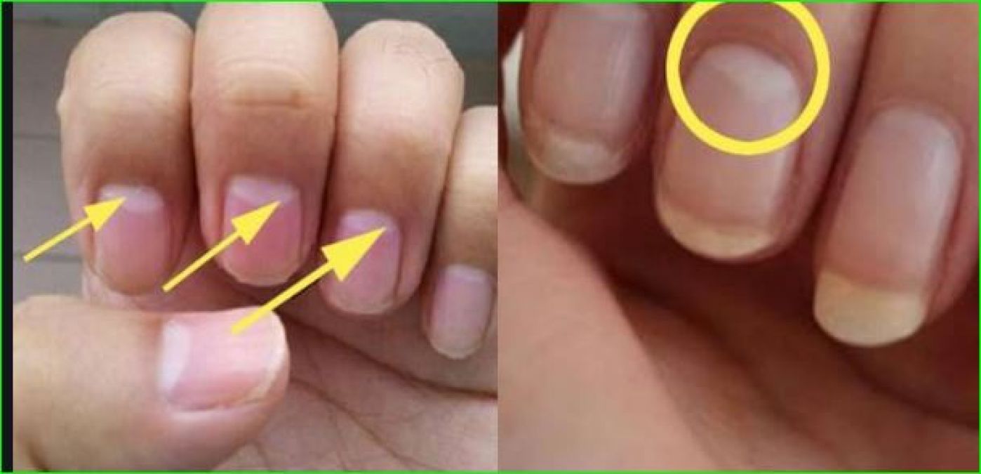 If you have this mark in your finger then your luck may progress |  NewsTrack English 1
