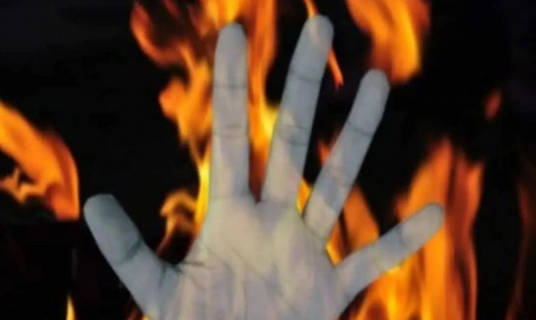 Alcoholic father set his son on fire in Hyderabad