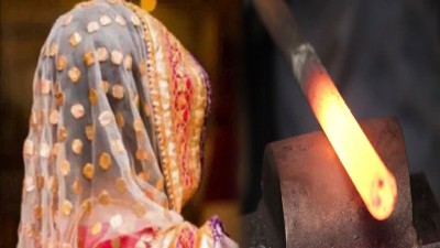 Husband burnt private parts with hot roads for refusing to give divorce