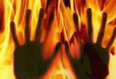 Husband sets wife on fire  alive due to illicit ties, registers case