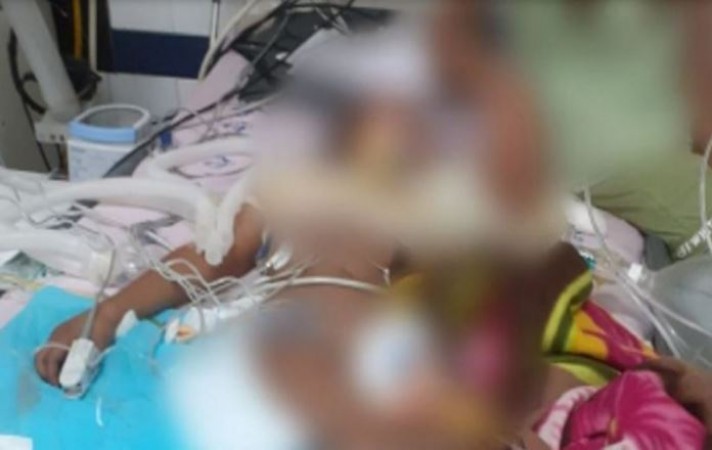 12 वर्षीय बच्चे के साथ 'निर्भया' जैसी दरिंदगी.., अस्पताल में जिंदगी की जंग लड़ रहा मासूम