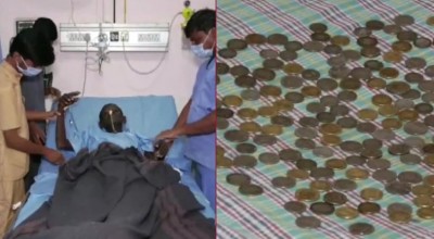 Karnataka Shocker: 187 coins removed from patient’s stomach