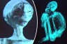 'He was alive..' Mexican doctors revealed about the alien's body