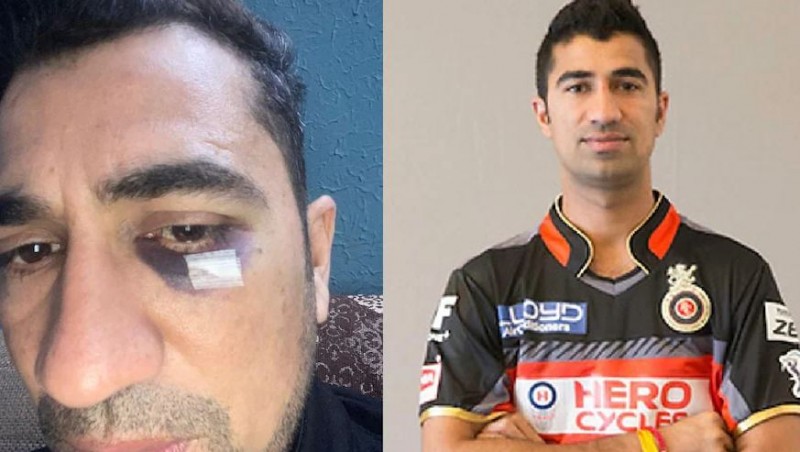 The police officer punched the cricketer in the face, the player's eye was saved