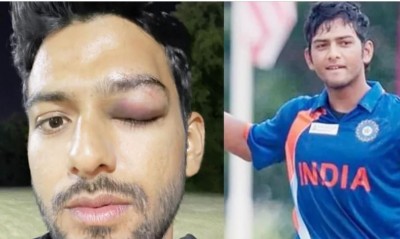 टीम इंडिया के पूर्व कप्तान को लगी गंभीर चोट, बाल-बाल बच गई आँख